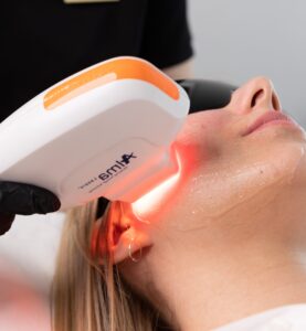 laserowe odmładzanie skóry