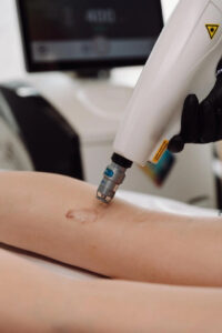 laser blizny Kielce Katarzyna Batkowska