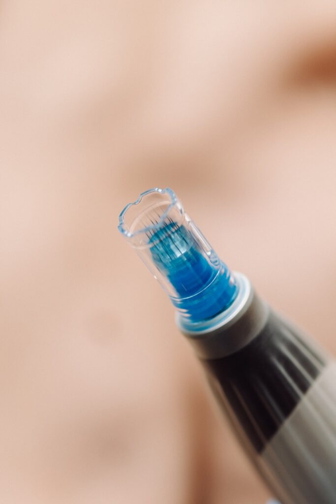 mezoterapia mikroigłowa Kielce Katarzyna Batkowska